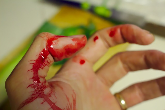 krvácení prstu